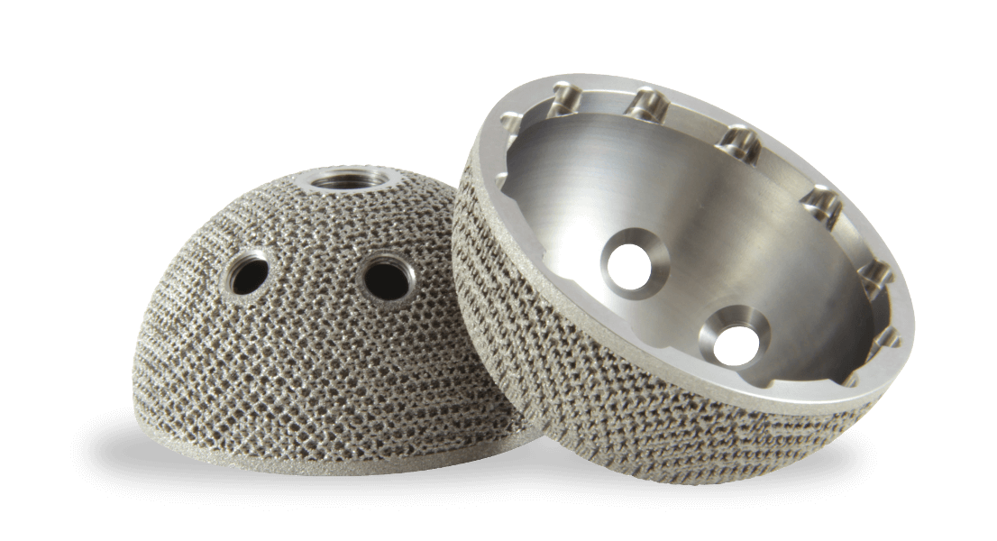 Additive Manufacturing Implant