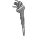 SMR TT Hybrid Glenoid