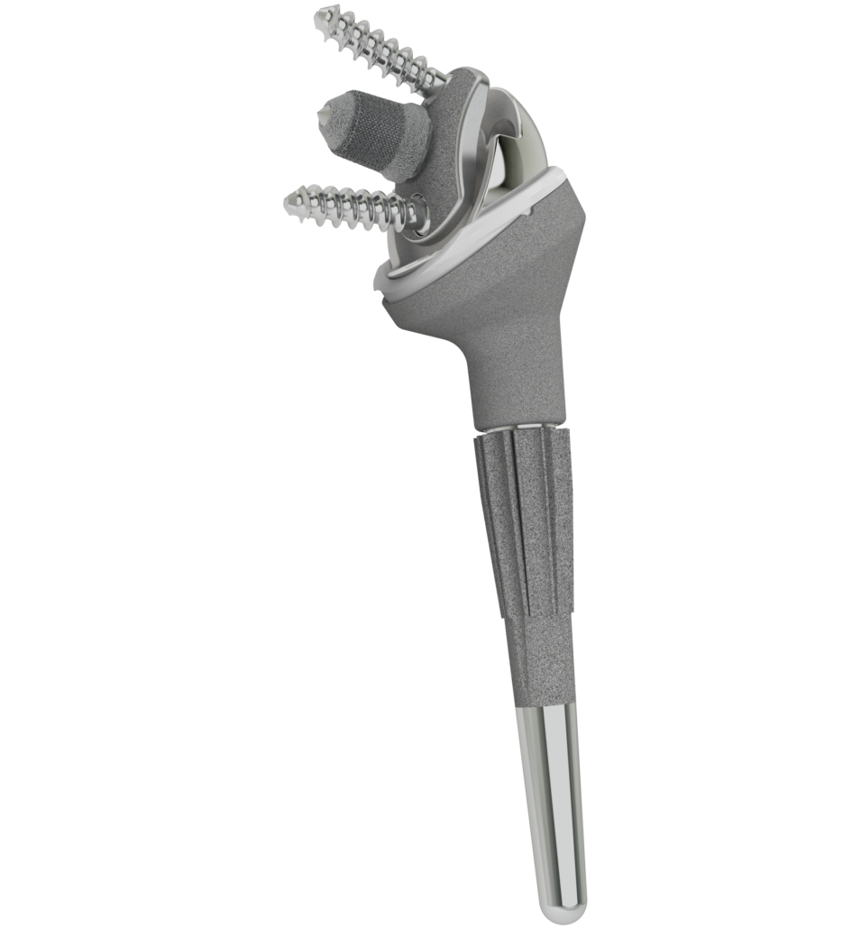SMR TT Hybrid Glenoid AMPOWER Report On Additive Manufacturing smr-tt-hybrid-glenoid-ampower-report-on-additive-manufacturing